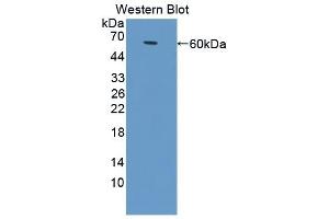 Detection of Recombinant ALCAM, Bovine using Polyclonal Antibody to Activated Leukocyte Cell Adhesion Molecule (ALCAM) (CD166 抗体  (AA 28-527))