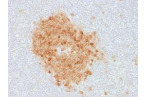 Immunohistochemistry (IHC) image for anti-Membrane Metallo-Endopeptidase (MME) (AA 297-483) antibody (ABIN6940061)