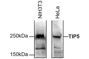 Western Blot of anti-TIP5 antibody Western Blot results of Rabbit anti-TIP5 antibody. (BAZ2A 抗体)
