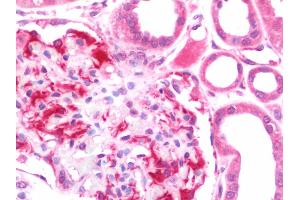 Anti-SCNN1A / ENaC Apha antibody IHC staining of human kidney.