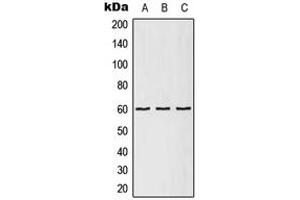 Western blot analysis of TCP1 epsilon expression in A431 (A), Raw264.