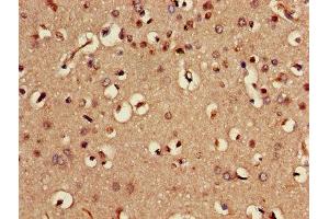 Immunohistochemistry of paraffin-embedded human brain tissue using ABIN7168982 at dilution of 1:100 (STK24 抗体  (AA 1-431))
