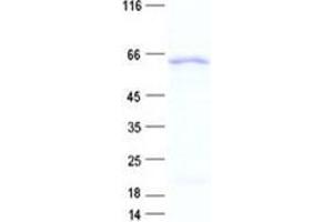 Validation with Western Blot (WT1 Protein (His tag))