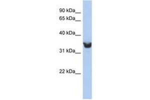 Image no. 1 for anti-delta-Like 1 Homolog (Drosophila) (DLK1) (AA 251-300) antibody (ABIN6743247) (DLK1 抗体  (AA 251-300))