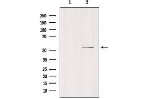 Western blot analysis of extracts from mouse brain, using MOT6 Antibody. (SLC16A5 抗体  (Internal Region))