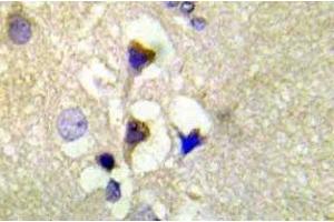 Immunohistochemistry (IHC) analyzes of p-PKD1/PKC-mu antibody in paraffin-embedded human brain tissue. (PKC mu 抗体  (pSer910))