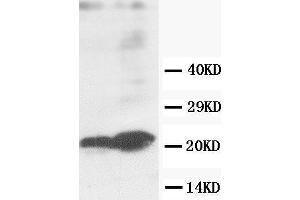 Anti-GST3/GST pi antibody, Western blotting Lane 1: MCF-7 Cell Lysate Lane 2: COLO320 Cell Lysate (GSTP1 抗体  (C-Term))