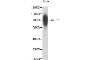 Western blot analysis of extracts of HeLa cells, using ALPP antibody (ABIN2561070) at 1:1000 dilution. (PLAP 抗体)