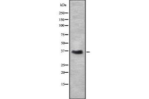 Western blot analysis of DAZL using Jurkat whole cell lysates (DAZL 抗体  (Internal Region))