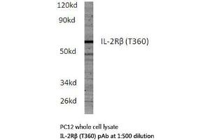 Western blot (WB) analysis of IL-2Rβ antibody in extracts from PC12 cells. (IL2 Receptor beta 抗体)