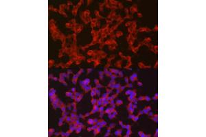 Immunofluorescence analysis of SH-SY5Y cells using Ret Rabbit pAb (ABIN6130657, ABIN6146873, ABIN6146874 and ABIN6213585) at dilution of 1:50 (40x lens). (Ret Proto-Oncogene 抗体  (AA 29-300))