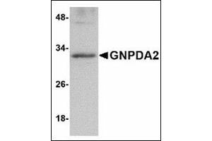 Western blot analysis of GNPDA2 in human kidney lysate with GNPDA2 antibody at 1 µg/ml. (GNPDA2 抗体  (C-Term))