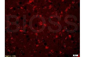 Formalin-fixed and paraffin embedded rat brain labeled with Rabbit Anti BNP Polyclonal Antibody, Unconjugated (ABIN678623) at 1:200 followed by conjugation to the secondary antibody and DAB staining (BNP 抗体  (AA 85-115))