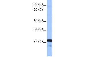 WB Suggested Anti-SFRS9 Antibody Titration: 0. (SFRS9 抗体  (Middle Region))
