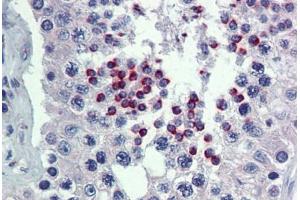 Immunohistochemistry (Formalin-fixed Paraffin-embedded Sections) (IHC (fp)) image for anti-POU Class 5 Homeobox 1 (POU5F1) (AA 6-152) antibody (ABIN574120)