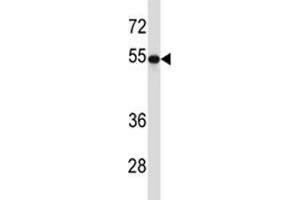 TUBB2A antibody western blot analysis in 293 lysate. (TUBB2A 抗体  (AA 410-438))