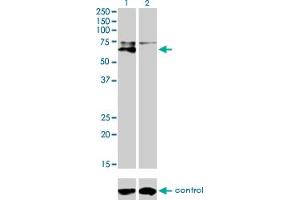 Western blot analysis of ALPL over-expressed 293 cell line, cotransfected with ALPL Validated Chimera RNAi (Lane 2) or non-transfected control (Lane 1). (ALPL 抗体  (AA 91-200))