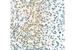 Immunohistochemistry (Paraffin-embedded Sections) (IHC (p)) image for anti-Sp7 Transcription Factor (SP7) antibody (ABIN7075694)
