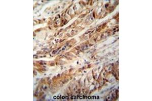 Immunohistochemistry (Paraffin-embedded Sections) (IHC (p)) image for anti-Zinc Finger CCCH-Type Containing 15 (ZC3H15) (AA 370-399), (C-Term) antibody (ABIN955636)