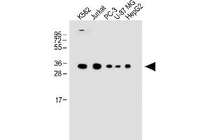 All lanes : Anti-P1R3G Antibody (C-term) at 1:1000 dilution Lane 1: K562 whole cell lysate Lane 2: Jurkat whole cell lysate Lane 3: PC-3 whole cell lysate Lane 4: U-87 MG whole cell lysate Lane 5: HepG2 whole cell lysate Lysates/proteins at 20 μg per lane. (PPP1R3G 抗体  (C-Term))