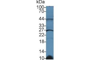 Western Blot; Sample: Human Raji cell lysate; Primary Ab: 2µg/ml Rabbit Anti-Rat GSTk1 Antibody Second Ab: 0. (GSTK1 抗体  (AA 20-214))
