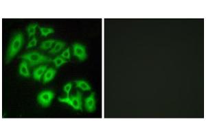 Immunofluorescence analysis of A549 cells, using FZD4 antibody. (FZD4 抗体  (Internal Region))