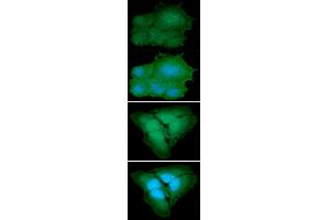 ICC/IF analysis of PARK7 in Hep3B cells line, stained with DAPI (Blue) for nucleus staining and monoclonal anti-human PARK7 antibody (1:100) with goat anti-mouse IgG-Alexa fluor 488 conjugate (Green). (PARK7/DJ1 抗体  (AA 1-189))