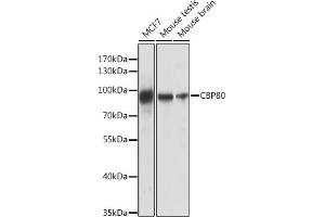 Western blot analysis of extracts of various cell lines, using CBP80 antibody (ABIN6134006, ABIN6138009, ABIN6138010 and ABIN6218117) at 1:1000 dilution. (NCBP1 抗体)