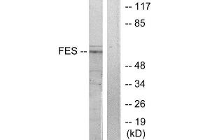 Western Blotting (WB) image for anti-Feline Sarcoma Oncogene (FES) (Internal Region) antibody (ABIN1849116) (FES 抗体  (Internal Region))