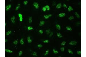 IF analysis of CTBP2 using anti-CTBP2 antibody (ABIN3042768). (CTBP2 抗体  (AA 321-445))