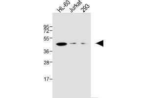 All lanes : Anti-EDG6 Antibody at 1:1000 dilution Lane 1: HL-60 whole cell lysate Lane 2: Jurkat whole cell lysate Lane 3: 293 whole cell lysate Lysates/proteins at 20 μg per lane. (S1PR4 抗体  (N-Term))