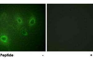 Immunofluorescence analysis of COS-7 cells, using ITPR1 polyclonal antibody . (ITPR1 抗体)