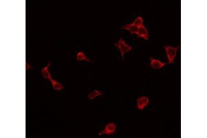 Immunofluorescence (fixed cells) (IF/ICC) image for anti-Glutamate Receptor, Ionotropic, N-Methyl D-Aspartate 2B (GRIN2B) (C-Term) antibody (ABIN6263669)