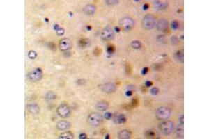 Used in DAB staining on fromalin fixed paraffin-embedded Brain tissue (Afamin 抗体  (AA 210-403))
