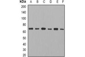 Western blot analysis of CCT3 expression in MCF7 (A), THP1 (B), mouse ovary (C), mouse thymus (D), rat spleen (E), rat heart (F) whole cell lysates. (CCT3 抗体)