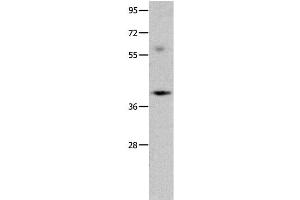 Western Blot analysis of Mouse brain tissue using OPCML Polyclonal Antibody at dilution of 1:400 (OPCML 抗体)