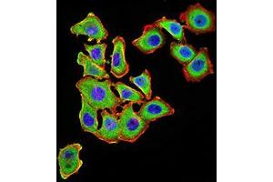 Immunocytochemistry (ICC) image for anti-Uncoupling Protein 3 (Mitochondrial, Proton Carrier) (UCP3) (AA 1-113), (AA 217-312) antibody (ABIN5871957) (UCP3 抗体  (AA 1-113, AA 217-312))