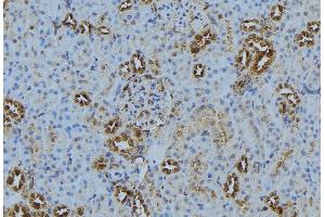 ABIN6272871 at 1/100 staining Mouse kidney tissue by IHC-P. (MKS1 抗体)