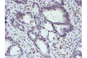 Image no. 5 for anti-WW Domain Containing Transcription Regulator 1 (WWTR1) antibody (ABIN1501763) (WWTR1 抗体)