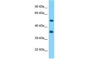 Western Blotting (WB) image for anti-serpin Peptidase Inhibitor, Clade B (Ovalbumin), Member 3 (SERPINB3) (Middle Region) antibody (ABIN5516527)