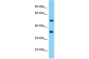 Host:  Rabbit  Target Name:  SERPINB3  Sample Type:  Thymus Tumor lysates  Antibody Dilution:  1. (SERPINB3 抗体  (Middle Region))