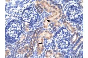 PCK1 antibody was used for immunohistochemistry at a concentration of 4-8 ug/ml to stain Epithelial cells of renal tubule (arrows) in Human Kidney. (PCK1 抗体  (Soluble))