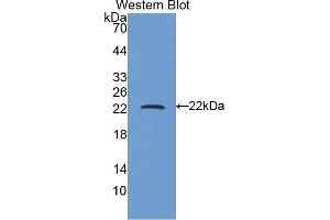 Western blot analysis of the recombinant protein. (FTH1 抗体  (AA 1-171))