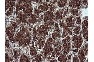 Image no. 7 for anti-Tripartite Motif Containing 44 (TRIM44) antibody (ABIN1501505)