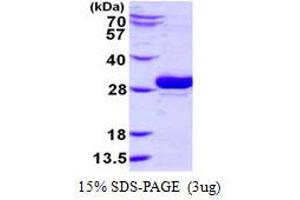 Ubiquitin-Conjugating Enzyme E2, J2 (UBE2J2) protein (His tag)
