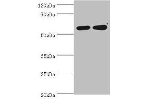 Western blot All lanes: P4HA2 antibody at 6 μg/mL Lane 1: HepG2 whole cell lysate Lane 2: 293T whole cell lysate Secondary Goat polyclonal to rabbit IgG at 1/10000 dilution Predicted band size: 61 kDa Observed band size: 61 kDa (P4HA2 抗体  (AA 236-535))