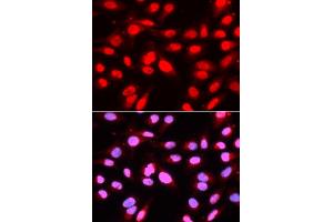 Immunofluorescence analysis of U2OS cells using U2AF2 antibody. (U2AF2 抗体)