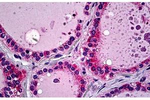 Human Thyroid: Formalin-Fixed, Paraffin-Embedded (FFPE) (SFTPD 抗体  (AA 21-376))