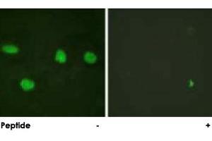Immunofluorescence analysis of HeLa cells, using TP53BP1 polyclonal antibody . (TP53BP1 抗体)