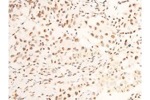 Immunohistochemistry (IHC) image for anti-Neurotrophic Tyrosine Kinase, Receptor, Type 1 (NTRK1) (pTyr681), (Tyr680) antibody (ABIN6256787)